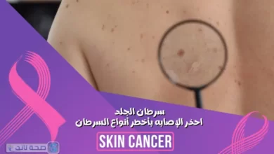سرطان الجلد .. احذر الإصابه بأخطر أنواع السرطان