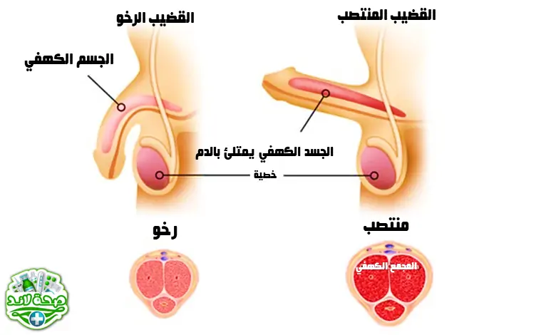 صورة توضيحية للانتصاب وعدم الانتصاب