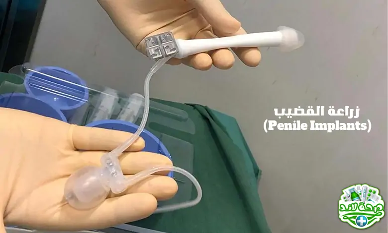 زراعة القضيب (Penile Implants)