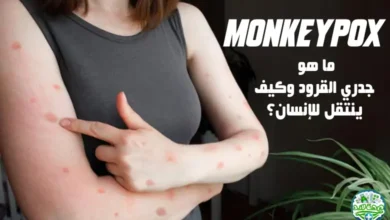 ما هو جدري القرود (Monkeypox) وما هي أعراضه وطرق علاجة؟