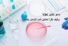 ماهو تحليل CBC؟ وكيف تقرأ تحاليل الدم الشامل بنفسك؟