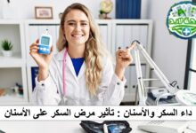 داء السكر والاسنان
