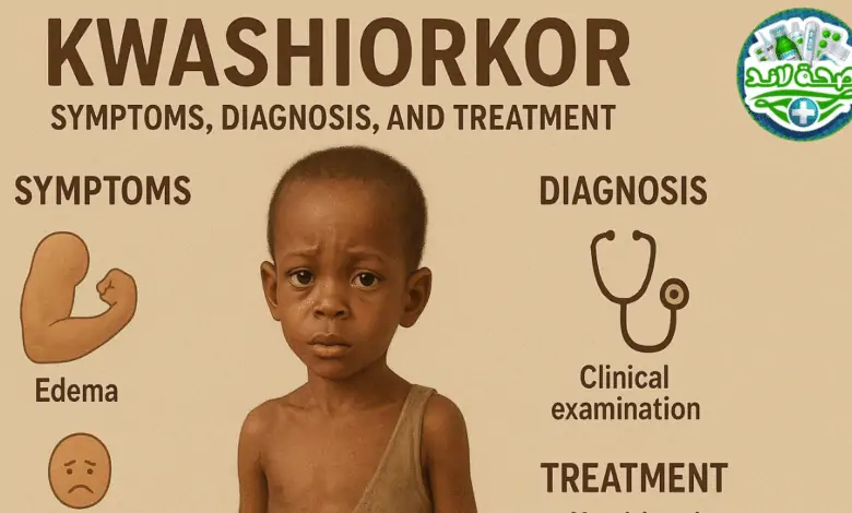 علاج الكواشيوركور