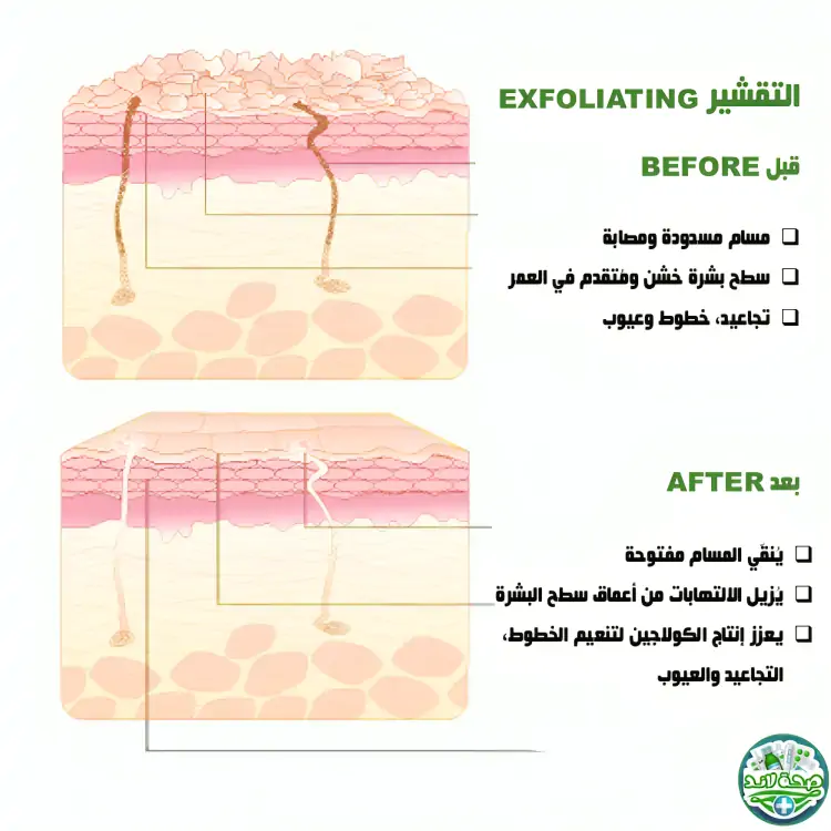 فائدة التقشير