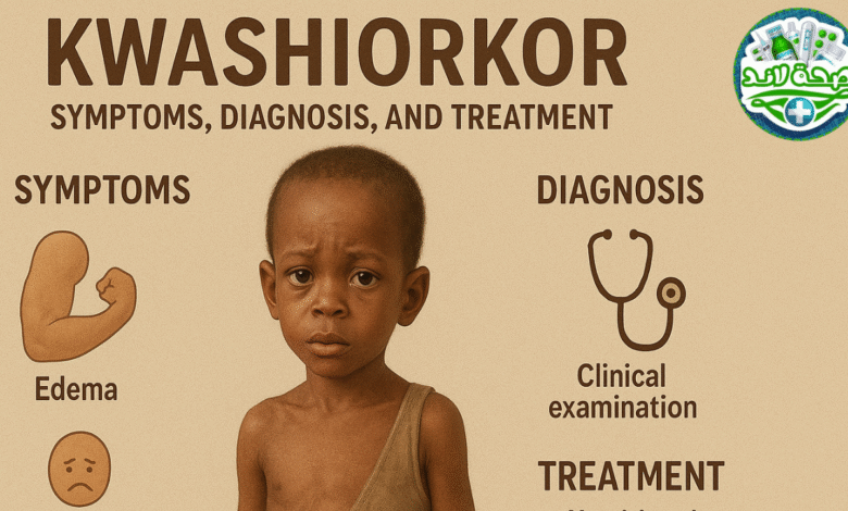 كواشيوركور Kwashiorkor نوع من سوء التغذية اعراض وتشخيص وطرق علاجه