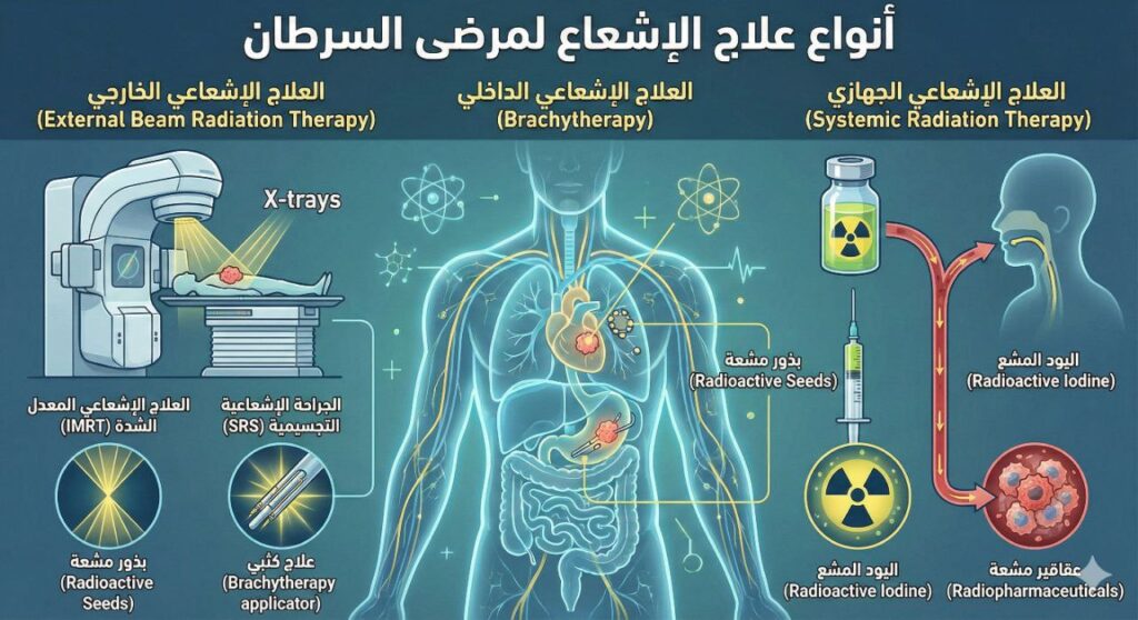 أنواع العلاج الإشعاعي