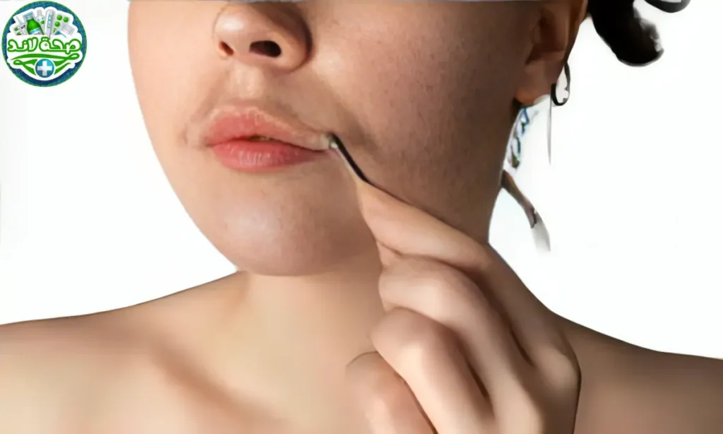 طرق استخدام نبات القصاري لمنع نمو الشعر غير المرغوب فيه