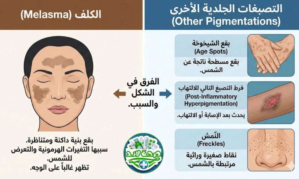 الفرق بين الكلف والتصبغات الجلدية الأخرى