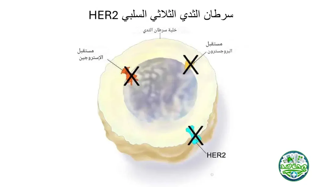 سرطان الثدي الثلاثي السلبي