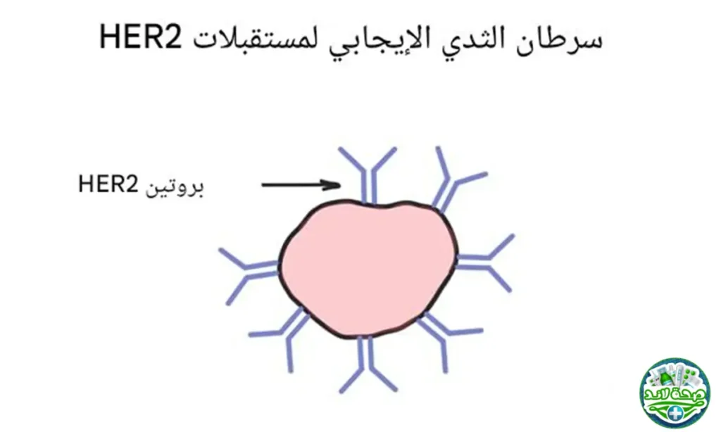 سرطان الثدي الإيجابي HER2