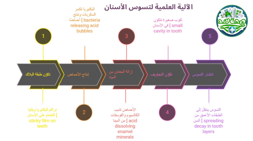 الآلية العلمية لتسوس الأسنان