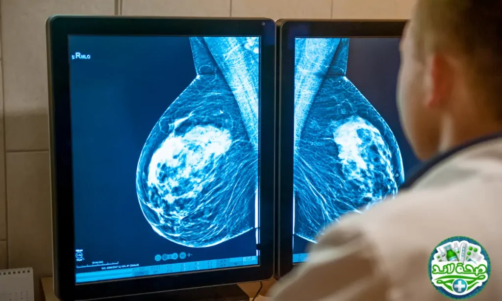 أجهزة تصوير الثدي (Mammogram) وأهمية الكشف المبكر