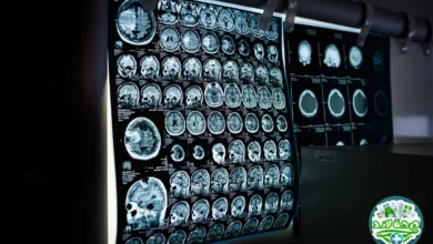 ما هي أجهزة الأشعة الطبية Medical Imaging Equipment؟ الدليل الشامل لتعرف أكثر