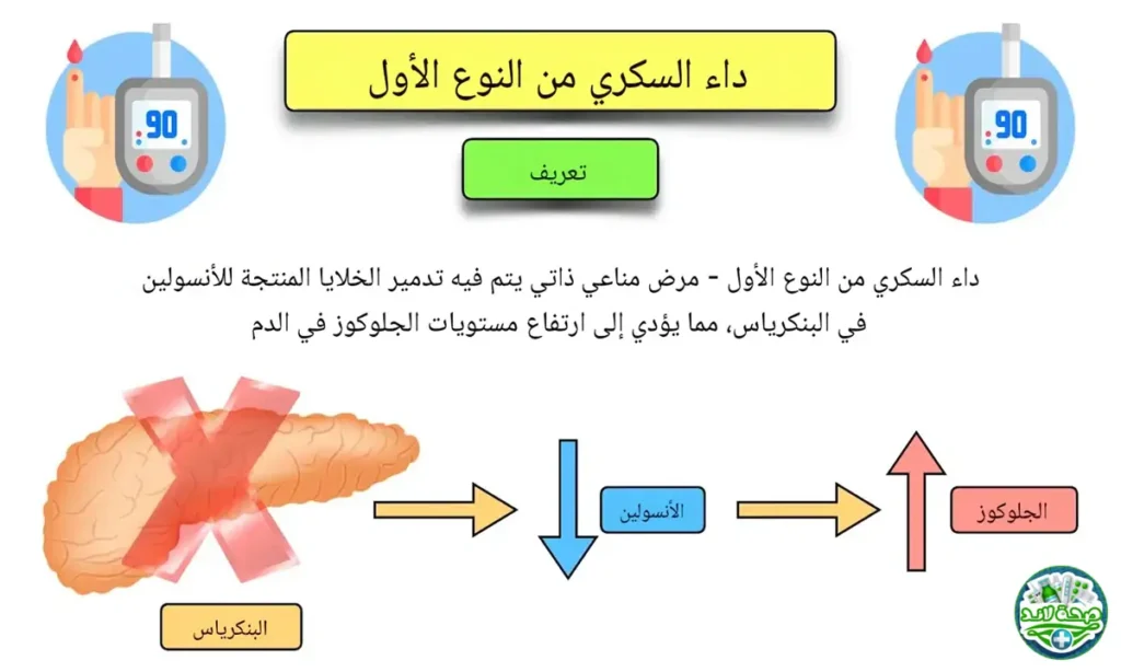 ما هو السكري من النوع الأول؟